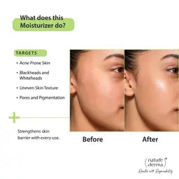 1% Natural Biome-Boost™ Moisturizer with Subligana - 50 ml